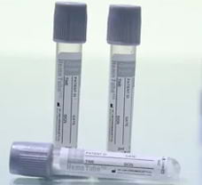 Blood Collection Tube Non Vacuum-Sodium Fluoride 2ml