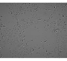Human Pancreatic Islets beta cells-HP-1701