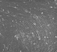 Human Umbilical Cord derived Mesenchymal stem cells(hUC-MSCs)- HU-1901