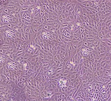 Human Umbilical Cord Vein Endothelial cells (hUVECs)- HU-1902