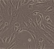 Kidney Epithelial cells (Diabetic Neuropathy)- HK-1601