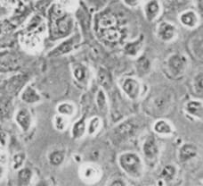 Mus Liver Hepatocytes- ML-3601