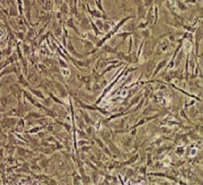 Swine Skeletal Muscles Fibroblast cells- ST-2851