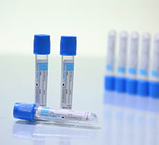 Vacuum Blood Collection Tubes-PTT 3.2% Citrate